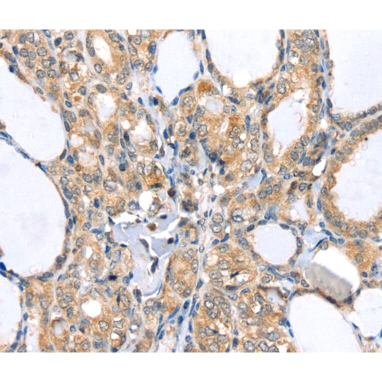 Immunohistochemistry - LLGL2 Antibody from Signalway Antibody (40198) - Antibodies.com