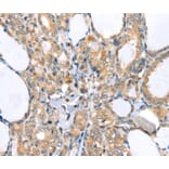 Immunohistochemistry - LLGL2 Antibody from Signalway Antibody (40198) - Antibodies.com