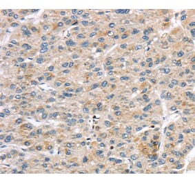 Immunohistochemistry - LZTS1 Antibody from Signalway Antibody (40201) - Antibodies.com