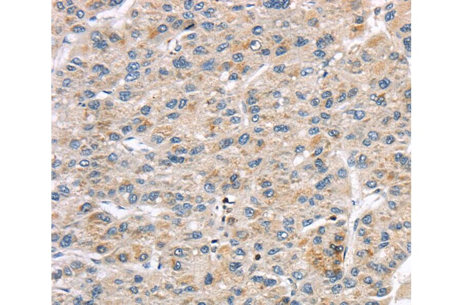 Immunohistochemistry - LZTS1 Antibody from Signalway Antibody (40201) - Antibodies.com