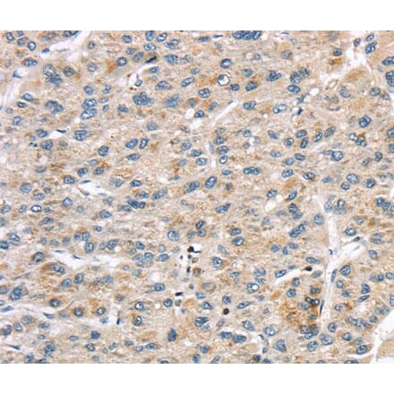 Immunohistochemistry - LZTS1 Antibody from Signalway Antibody (40201) - Antibodies.com