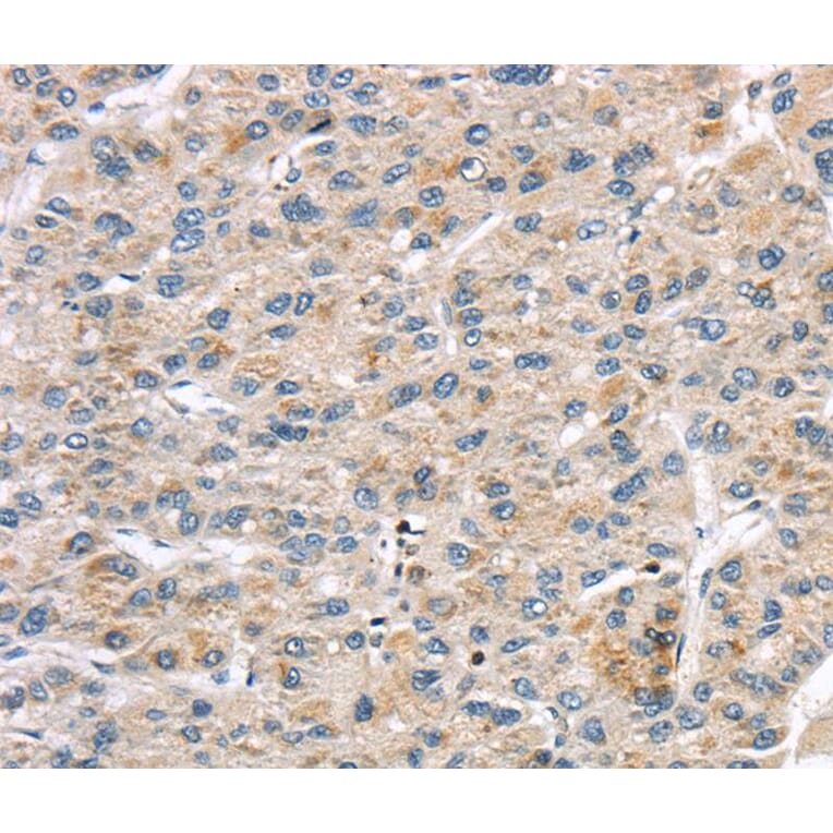 Immunohistochemistry - LZTS1 Antibody from Signalway Antibody (40201) - Antibodies.com