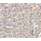 Immunohistochemistry - LZTS1 Antibody from Signalway Antibody (40201) - Antibodies.com
