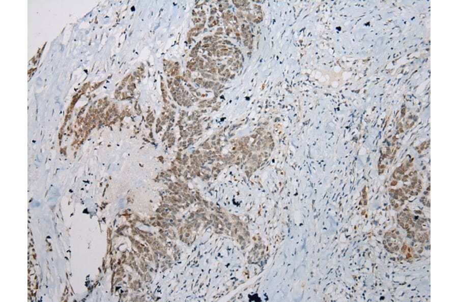 Immunohistochemistry - STAB1 Antibody from Signalway Antibody (40225) - Antibodies.com