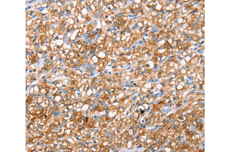 Immunohistochemistry - ABCC8 Antibody from Signalway Antibody (40228) - Antibodies.com