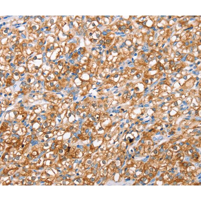 Immunohistochemistry - ABCC8 Antibody from Signalway Antibody (40228) - Antibodies.com