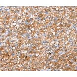 Immunohistochemistry - ABCC8 Antibody from Signalway Antibody (40228) - Antibodies.com