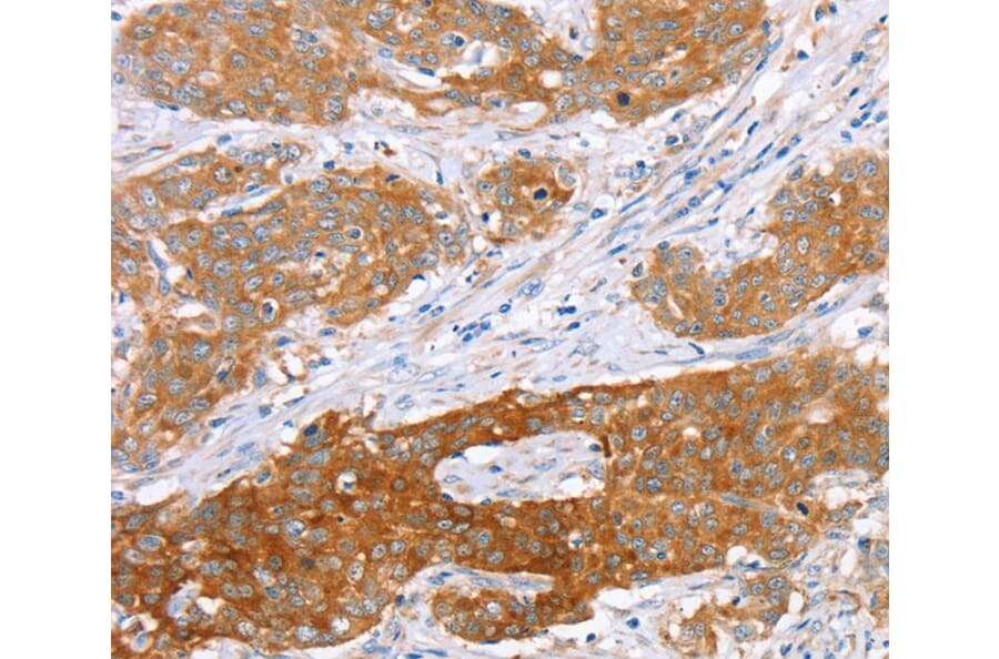 Immunohistochemistry - ABCC8 Antibody from Signalway Antibody (40228) - Antibodies.com