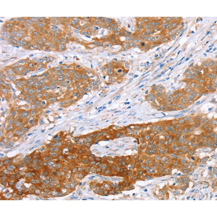 Immunohistochemistry - ABCC8 Antibody from Signalway Antibody (40228) - Antibodies.com