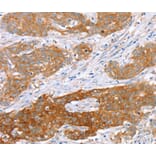 Immunohistochemistry - ABCC8 Antibody from Signalway Antibody (40228) - Antibodies.com