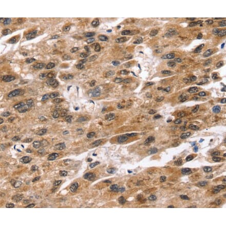 Immunohistochemistry - SNTA1 Antibody from Signalway Antibody (40233) - Antibodies.com