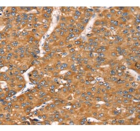 Immunohistochemistry - TGFB2 Antibody from Signalway Antibody (40241) - Antibodies.com