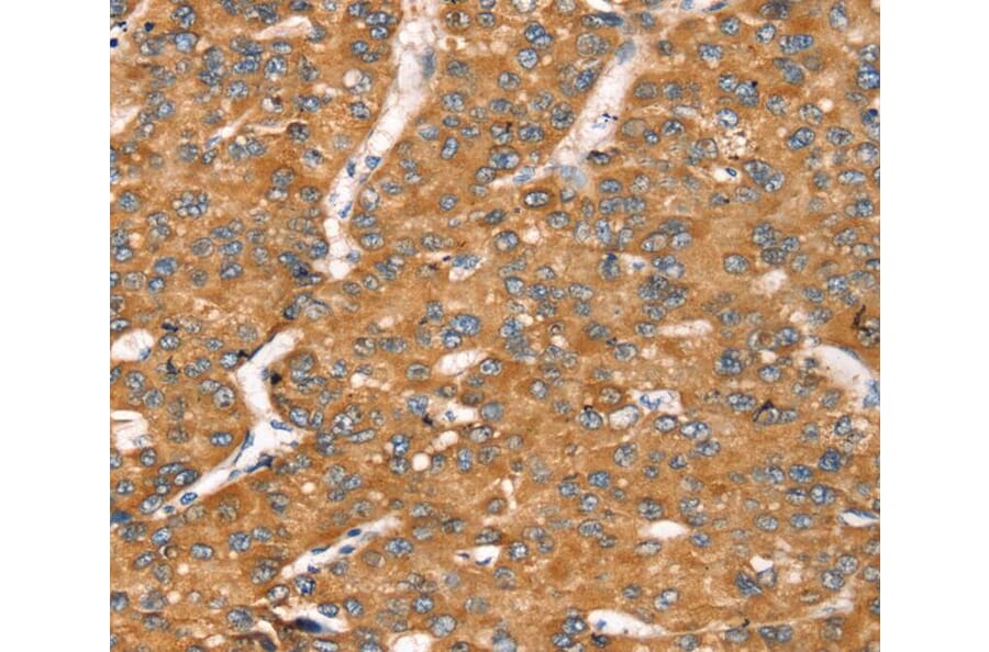 Immunohistochemistry - TGFB2 Antibody from Signalway Antibody (40241) - Antibodies.com