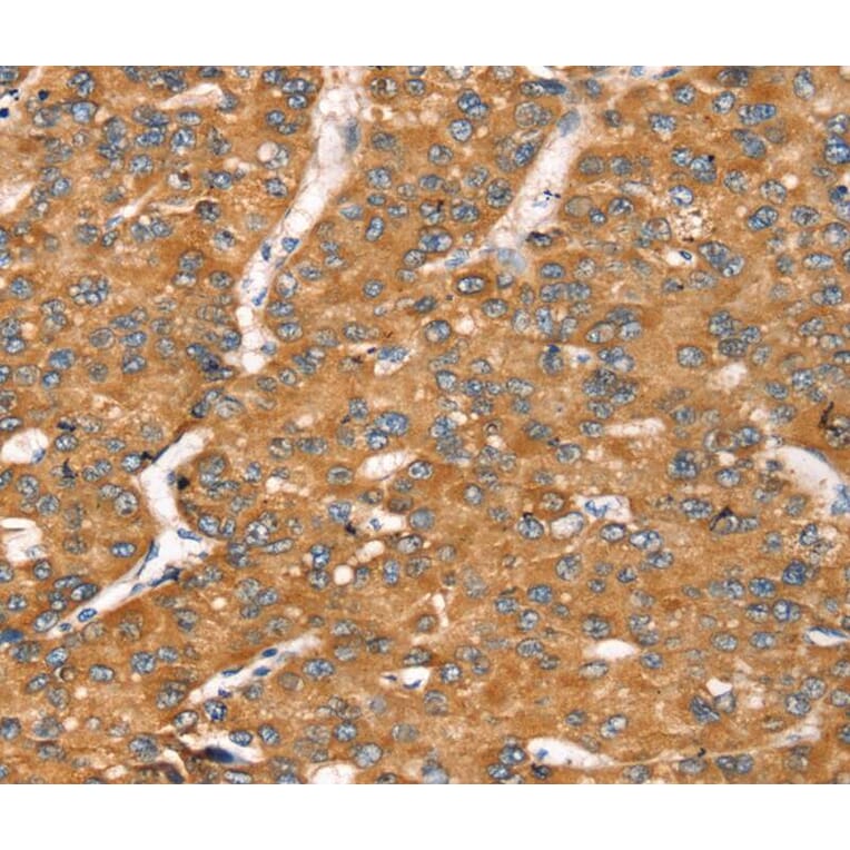 Immunohistochemistry - TGFB2 Antibody from Signalway Antibody (40241) - Antibodies.com