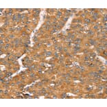 Immunohistochemistry - TGFB2 Antibody from Signalway Antibody (40241) - Antibodies.com