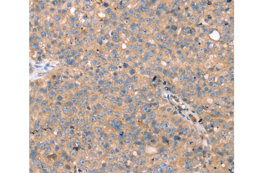Immunohistochemistry - TGFB2 Antibody from Signalway Antibody (40241) - Antibodies.com
