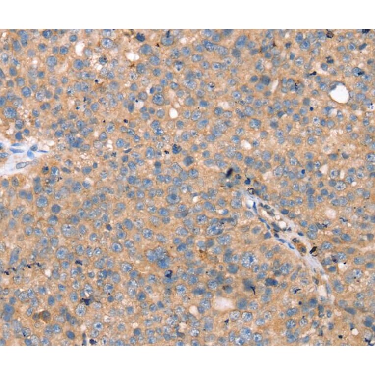 Immunohistochemistry - TGFB2 Antibody from Signalway Antibody (40241) - Antibodies.com