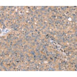 Immunohistochemistry - TGFB2 Antibody from Signalway Antibody (40241) - Antibodies.com
