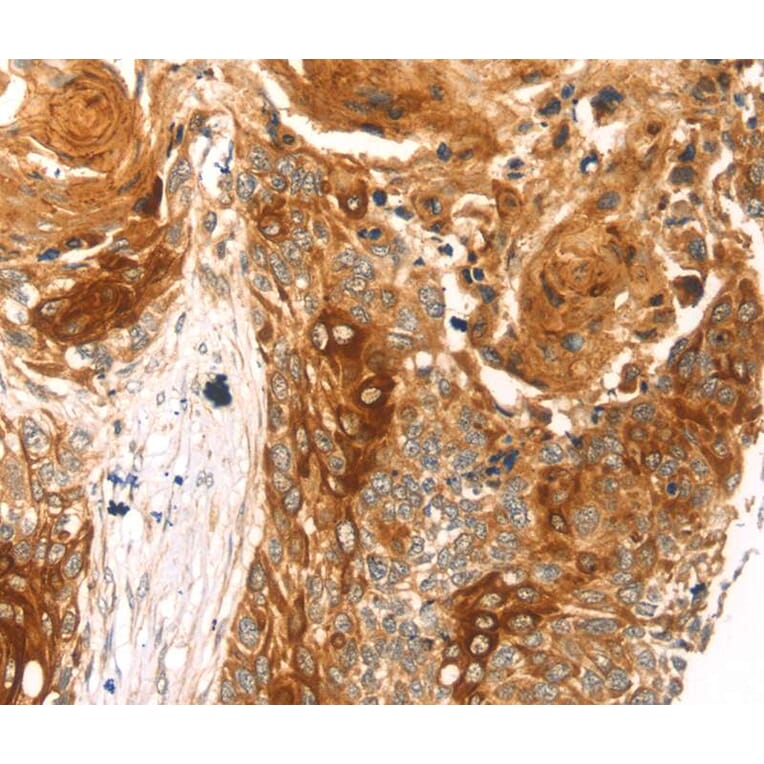 Immunohistochemistry - THAP9 Antibody from Signalway Antibody (40243) - Antibodies.com