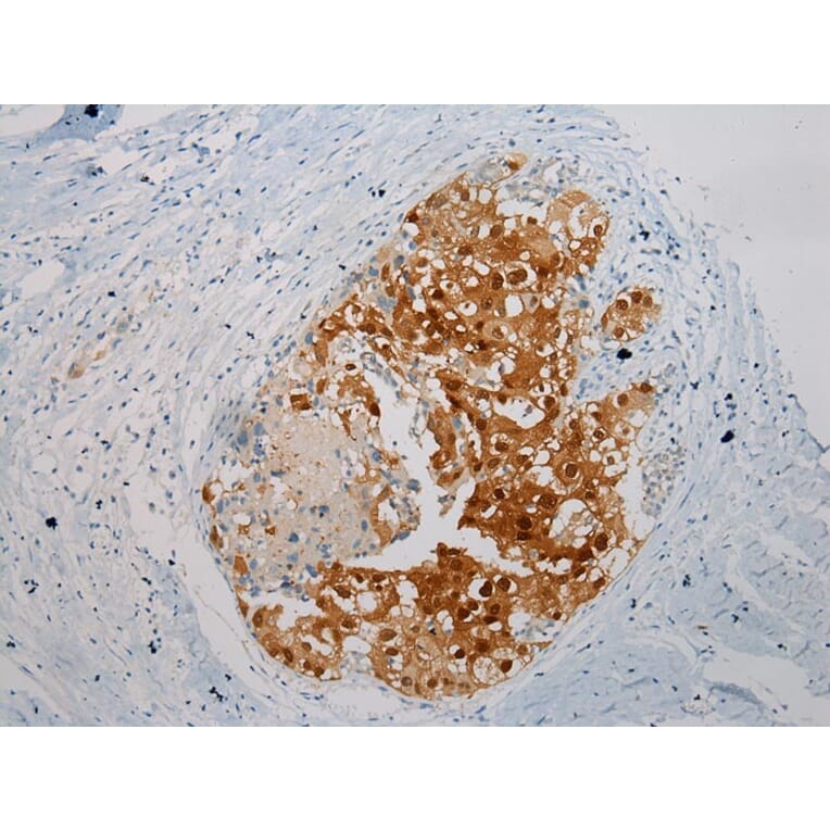 Immunohistochemistry - THBS2 Antibody from Signalway Antibody (40245) - Antibodies.com