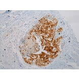 Immunohistochemistry - THBS2 Antibody from Signalway Antibody (40245) - Antibodies.com