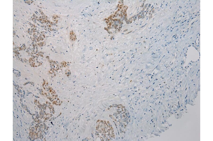 Immunohistochemistry - THBS2 Antibody from Signalway Antibody (40245) - Antibodies.com
