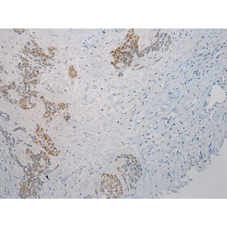 Immunohistochemistry - THBS2 Antibody from Signalway Antibody (40245) - Antibodies.com