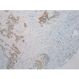 Immunohistochemistry - THBS2 Antibody from Signalway Antibody (40245) - Antibodies.com