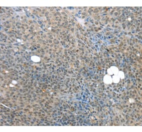 Immunohistochemistry - MED15 Antibody from Signalway Antibody (40263) - Antibodies.com