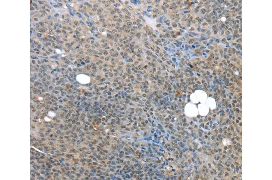 Immunohistochemistry - MED15 Antibody from Signalway Antibody (40263) - Antibodies.com