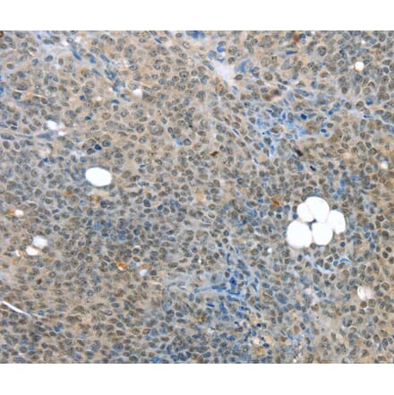 Immunohistochemistry - MED15 Antibody from Signalway Antibody (40263) - Antibodies.com