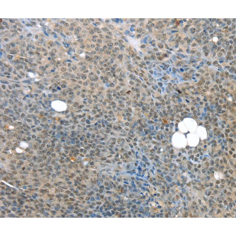 Immunohistochemistry - MED15 Antibody from Signalway Antibody (40263) - Antibodies.com