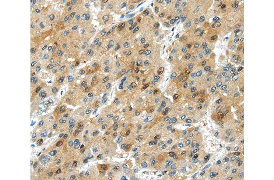 Immunohistochemistry - TRIB1 Antibody from Signalway Antibody (40265) - Antibodies.com