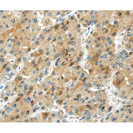 Immunohistochemistry - TRIB1 Antibody from Signalway Antibody (40265) - Antibodies.com