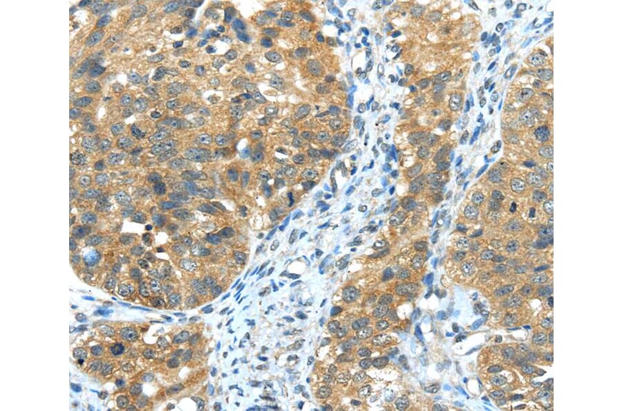 Immunohistochemistry - TRIB1 Antibody from Signalway Antibody (40265) - Antibodies.com