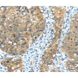 Immunohistochemistry - TRIB1 Antibody from Signalway Antibody (40265) - Antibodies.com