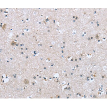 Immunohistochemistry - TRPM3 Antibody from Signalway Antibody (40266) - Antibodies.com