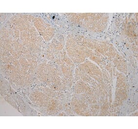 Immunohistochemistry - TSPY1 Antibody from Signalway Antibody (40270) - Antibodies.com