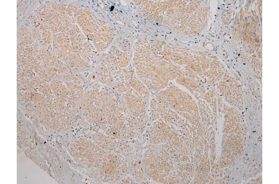 Immunohistochemistry - TSPY1 Antibody from Signalway Antibody (40270) - Antibodies.com