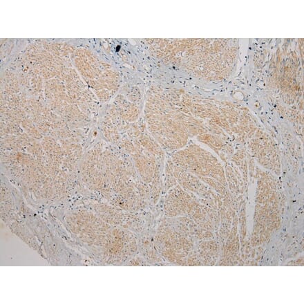 Immunohistochemistry - TSPY1 Antibody from Signalway Antibody (40270) - Antibodies.com