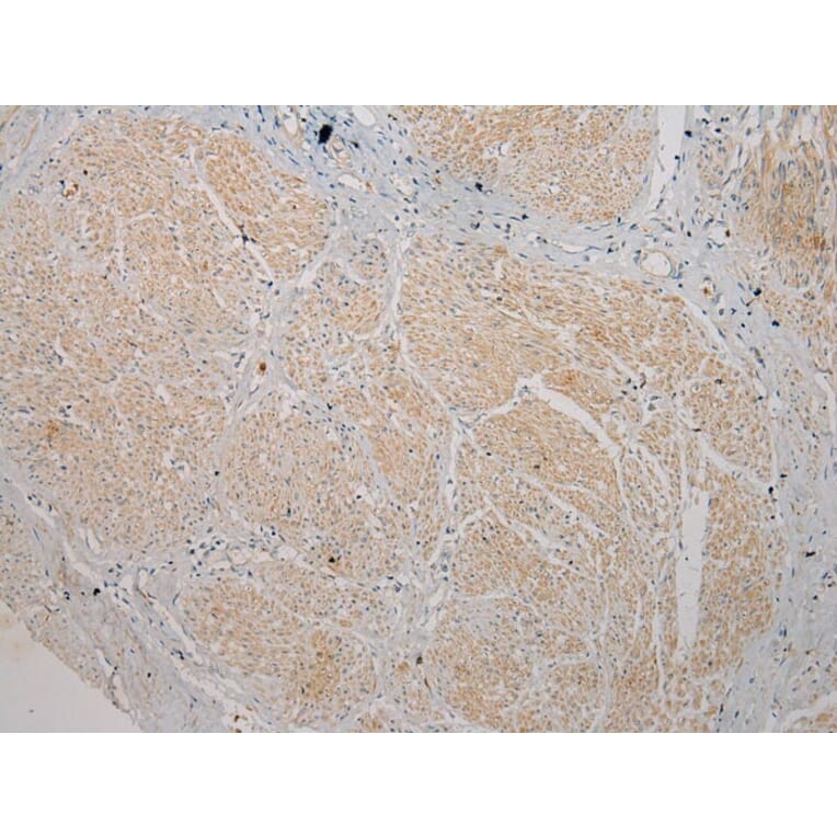 Immunohistochemistry - TSPY1 Antibody from Signalway Antibody (40270) - Antibodies.com
