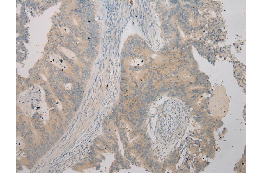 Immunohistochemistry - TSPY1 Antibody from Signalway Antibody (40270) - Antibodies.com