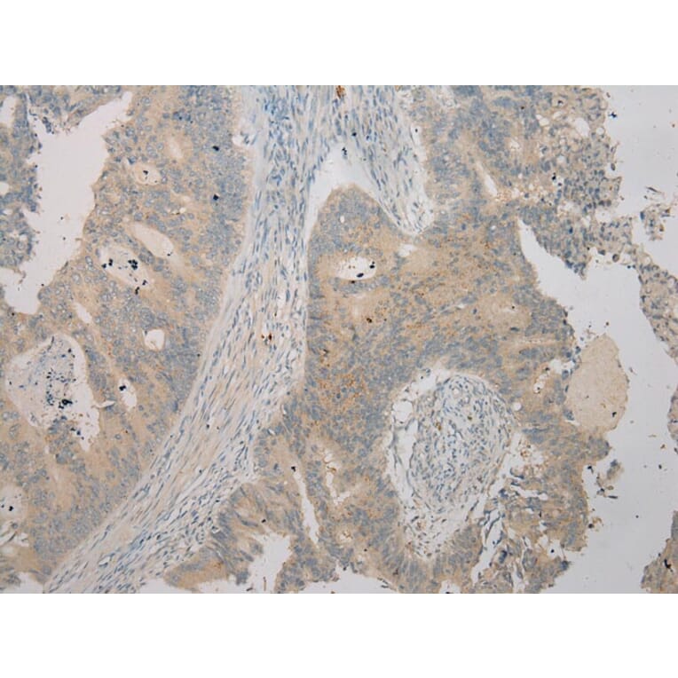 Immunohistochemistry - TSPY1 Antibody from Signalway Antibody (40270) - Antibodies.com