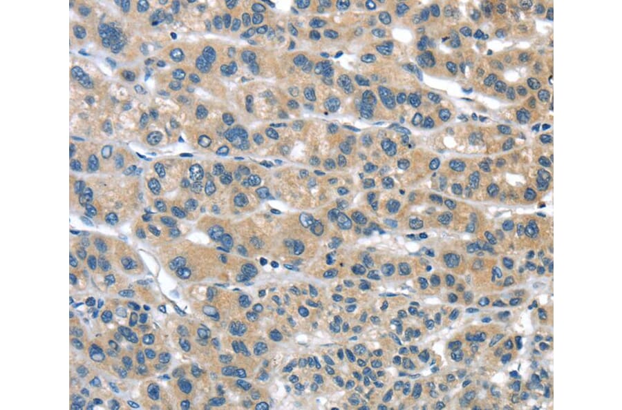 Immunohistochemistry - TUSC1 Antibody from Signalway Antibody (40272) - Antibodies.com