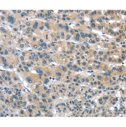 Immunohistochemistry - TUSC1 Antibody from Signalway Antibody (40272) - Antibodies.com