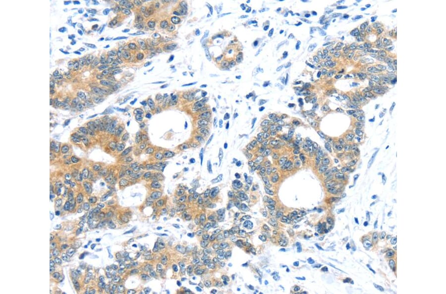 Immunohistochemistry - TUSC1 Antibody from Signalway Antibody (40272) - Antibodies.com