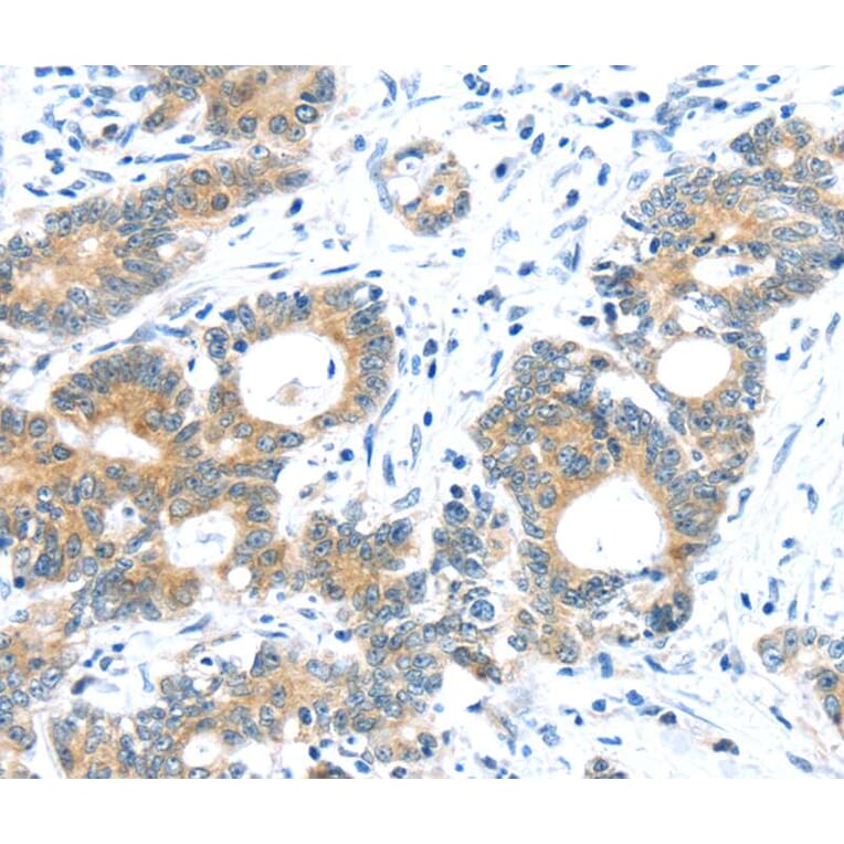 Immunohistochemistry - TUSC1 Antibody from Signalway Antibody (40272) - Antibodies.com