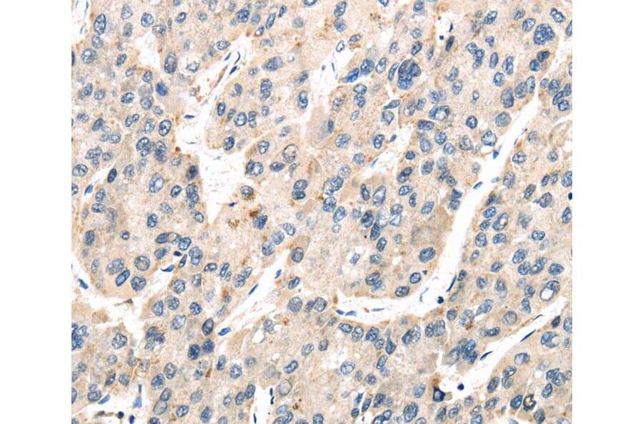 Immunohistochemistry - TXNIP Antibody from Signalway Antibody (40274) - Antibodies.com
