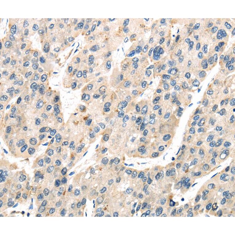 Immunohistochemistry - TXNIP Antibody from Signalway Antibody (40274) - Antibodies.com