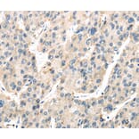 Immunohistochemistry - TXNIP Antibody from Signalway Antibody (40274) - Antibodies.com
